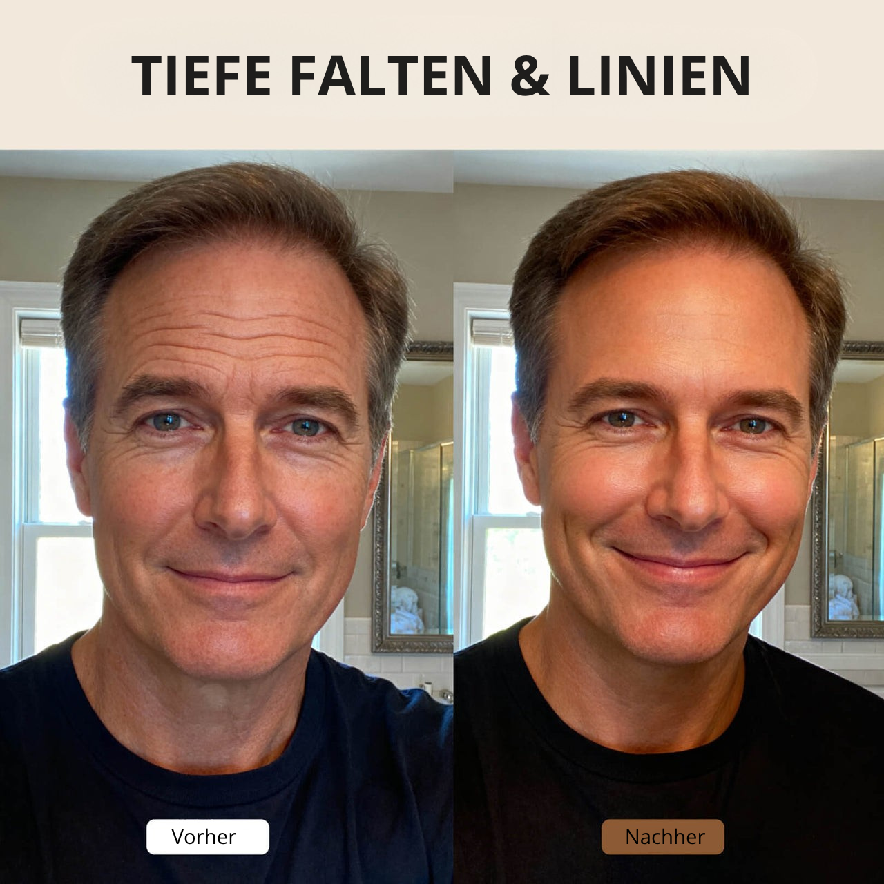 ForceSkin - Anti-Falten-Creme V2